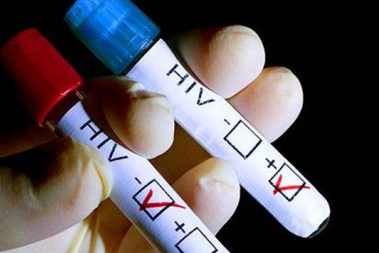 Testări HIV gratuite