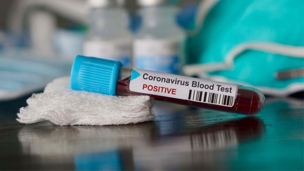 Coronavirus la Tulcea: 22 de cazuri noi raportate într-o singură zi