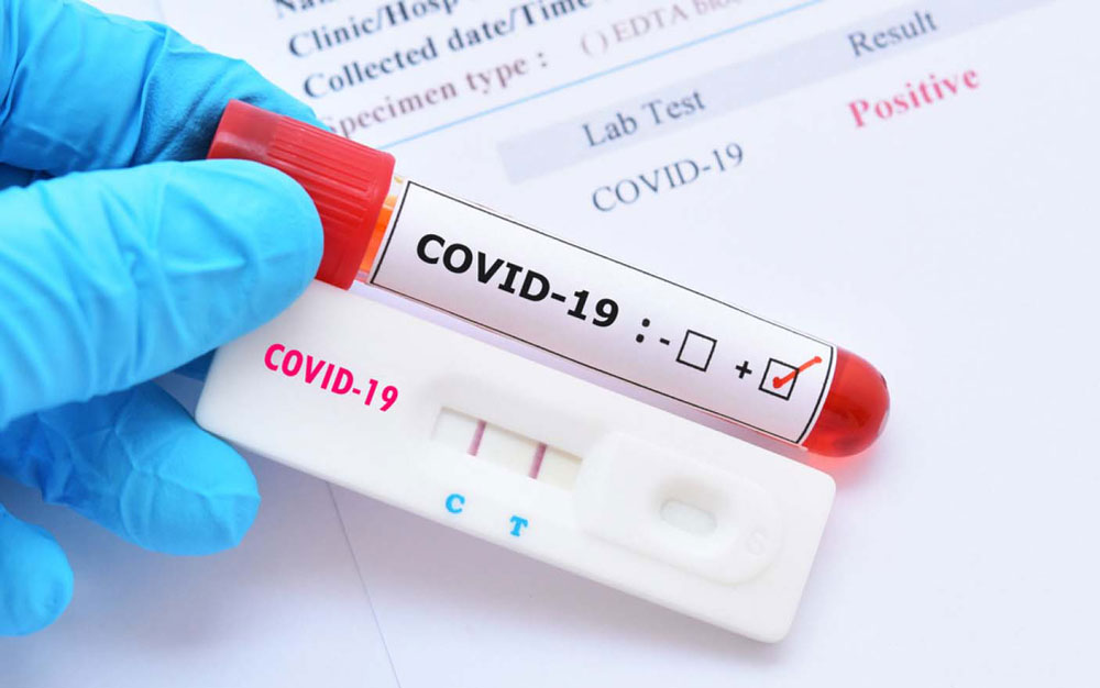 Record de infecţii COVID la Tulcea: 35 de cazuri raportate într-o zi