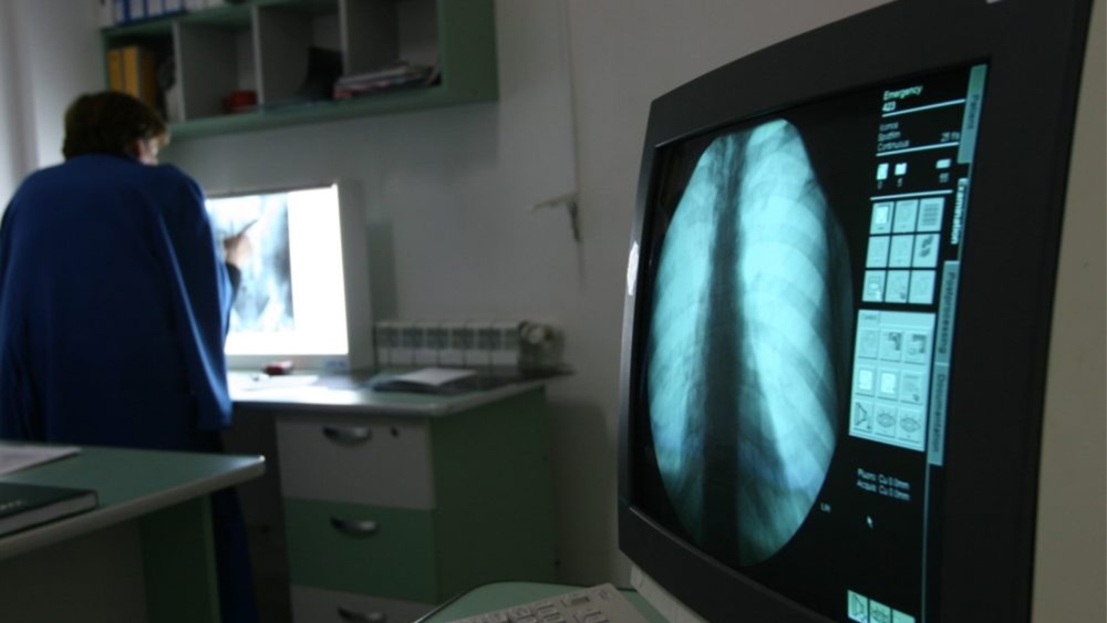 Spitalul Judeţean de Urgenţă Tulcea are două aparate portabile de radiologie pentru testarea bolnavilor de TBC